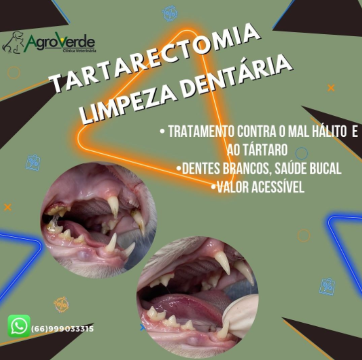 foto de TARTARECTOMIA