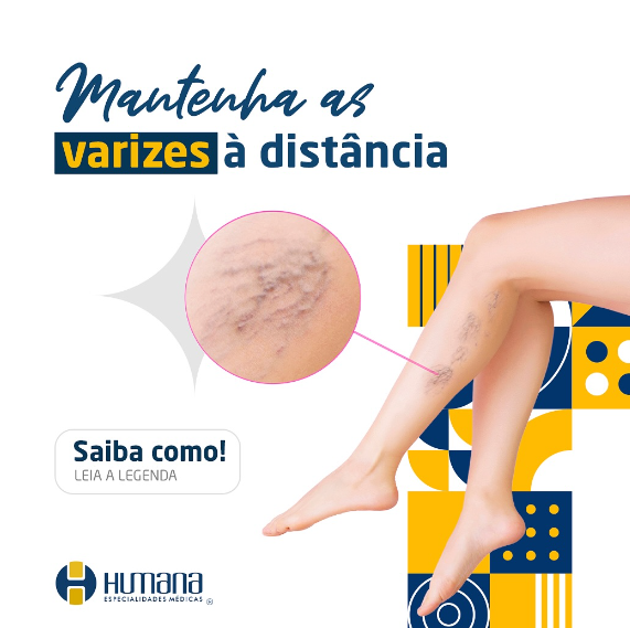 foto de MANTENHA AS VARIZES À DISTÂNCIA