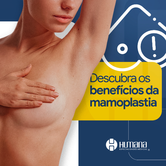 foto de BENEFÍCIOS DA MAMOPLASTIA