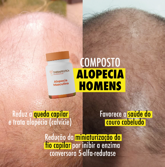 foto de COMPOSTO PARA TRATAR ALOPECIA